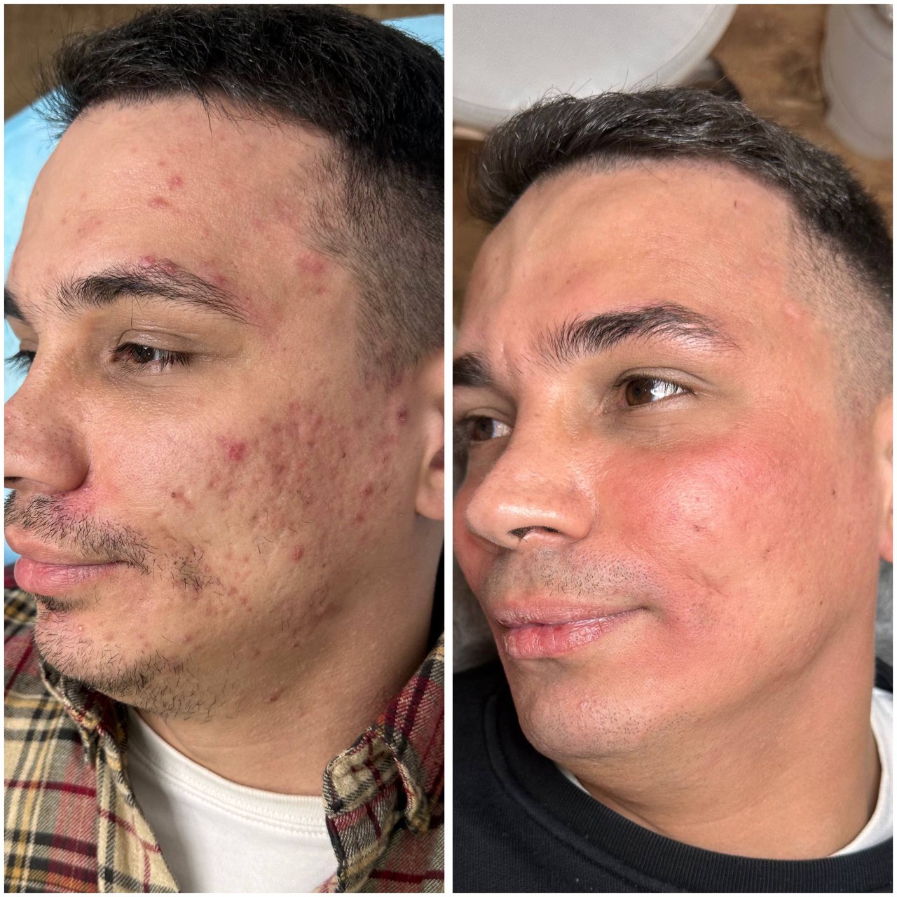 Результат лечения 5